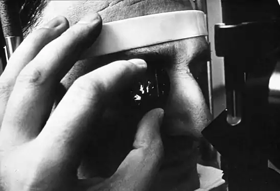 A physician using a "three-mirror glass" to diagnose retinal detachment