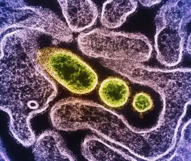 Transmission electron micrograph of mature extracellular Nipah Virus particles (yellow) near the periphery of an infected VERO cell
