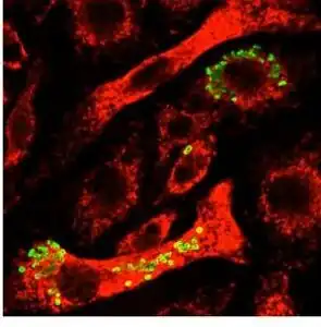 Image taken with a fluorescent microscope shows mouse macrophages  12 hours after infection with a virulent strain of Francisella tularensis (green)