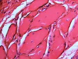 Silver sulfide deposits in the surrounding area of skeletal muscle fibers of the oral mucosa