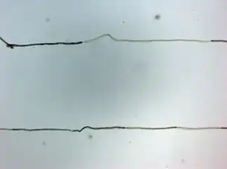 Histopathology of CIPD