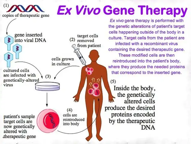 Ex vivo gene therapy