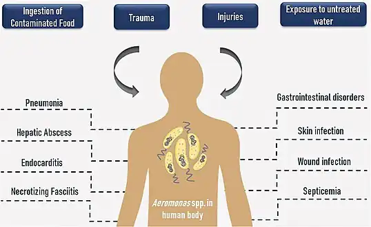 Routes and human health disorders due to Aeromonas spp