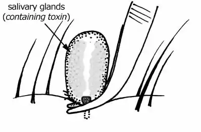 Tick removal. Compressing the body of the tick could cause more toxins to be injected into the host.