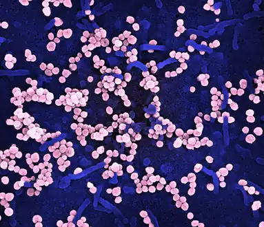 Scanning electron micrograph of Lassa virus budding off  cell