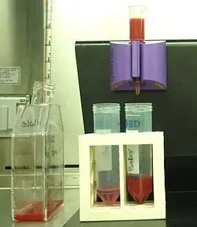 Magnetic collection of P.falciparum infected blood