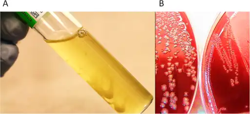 a)Yersinia pestis forms filamentous colonies in 150 g/L NaCl-broth b) small colonies (left), control (right ), Y. pestis exposed to 150 g/L