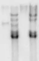 Southern blot  autoradiography