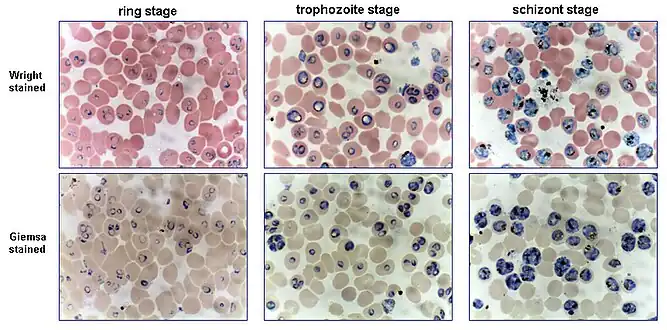 P. falciparum cultures