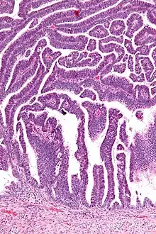 Intermediate magnification