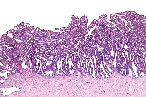 Very low magnification