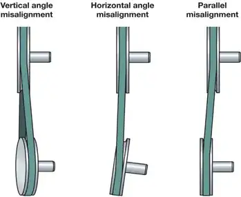 Pulley misalignment types
